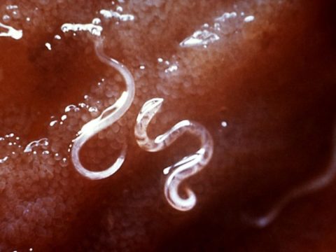 hookworms are gross