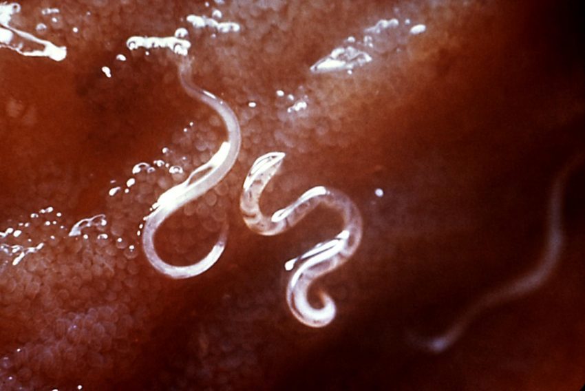 hookworms are gross